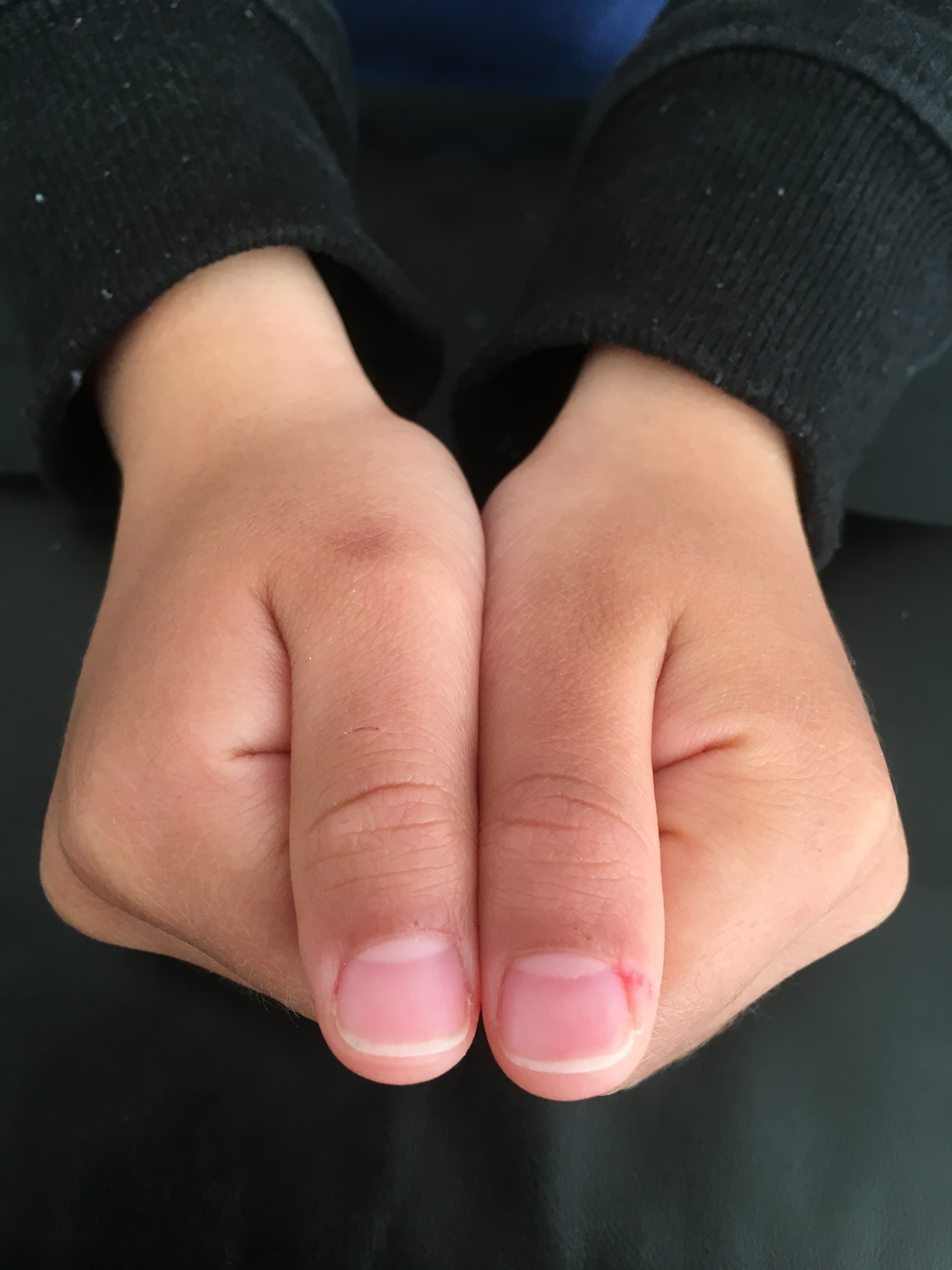 親子で通える ケアを徹底重視した かかりつけ ネイルサロン 日刊あわわ