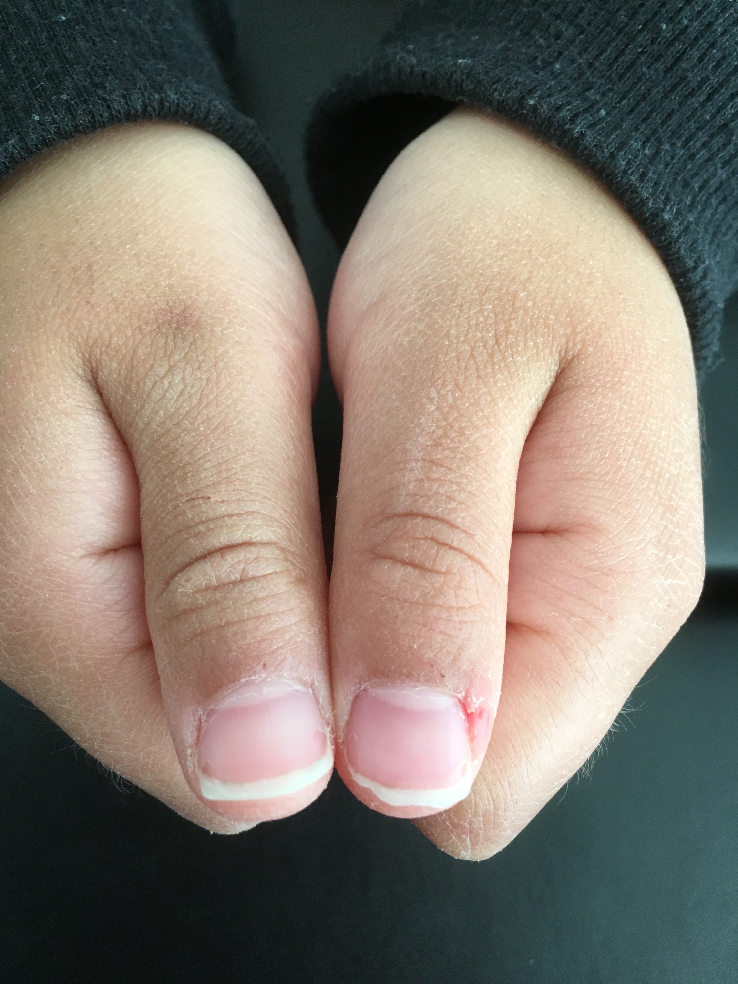 親子で通える ケアを徹底重視した かかりつけ ネイルサロン 日刊あわわ